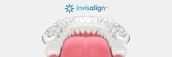 Why Invisalign Is a Popular Choice for Straightening Teeth