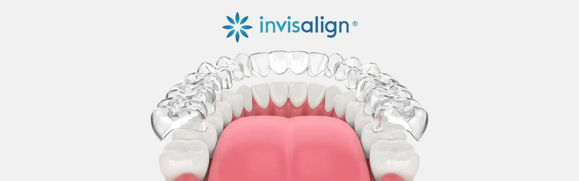 Why Invisalign Is a Popular Choice for Straightening Teeth