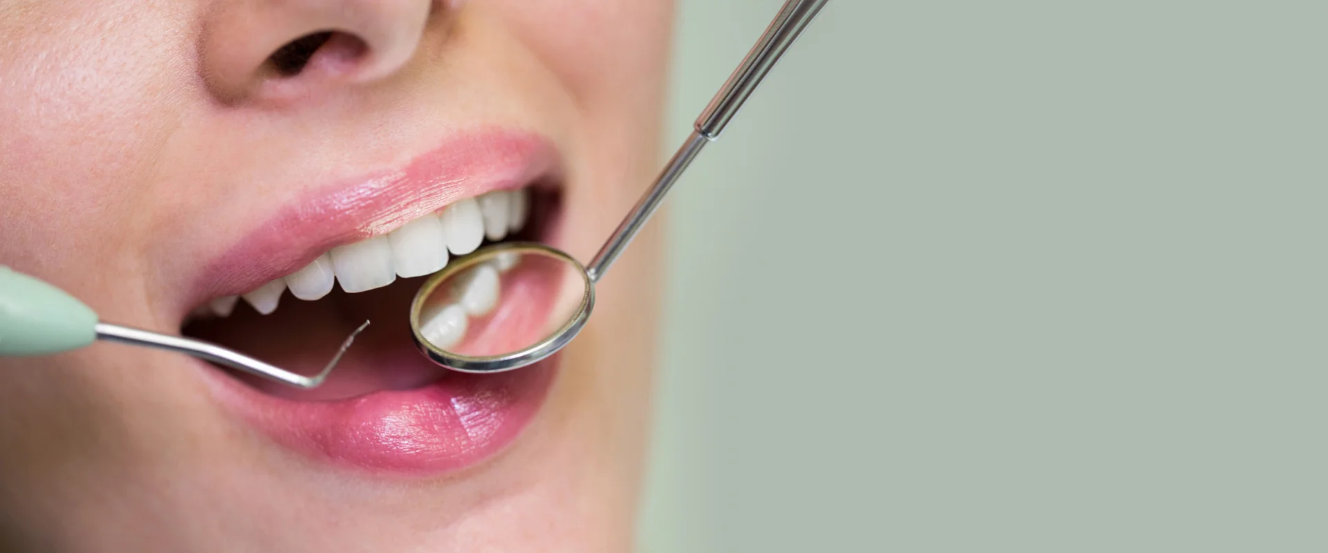 Teeth Whitening Special – $495