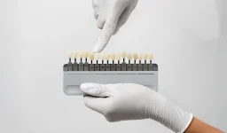 Dental Veneers in Washington, DC: What You Need to Know