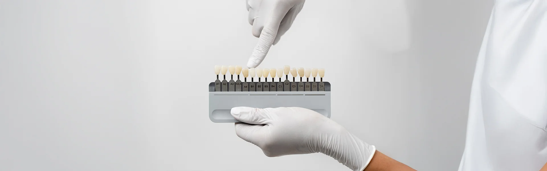 Dental Veneers in Washington, DC: What You Need to Know